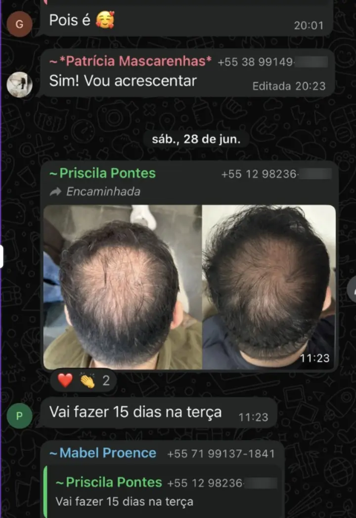 Resultado real — 15 dias
