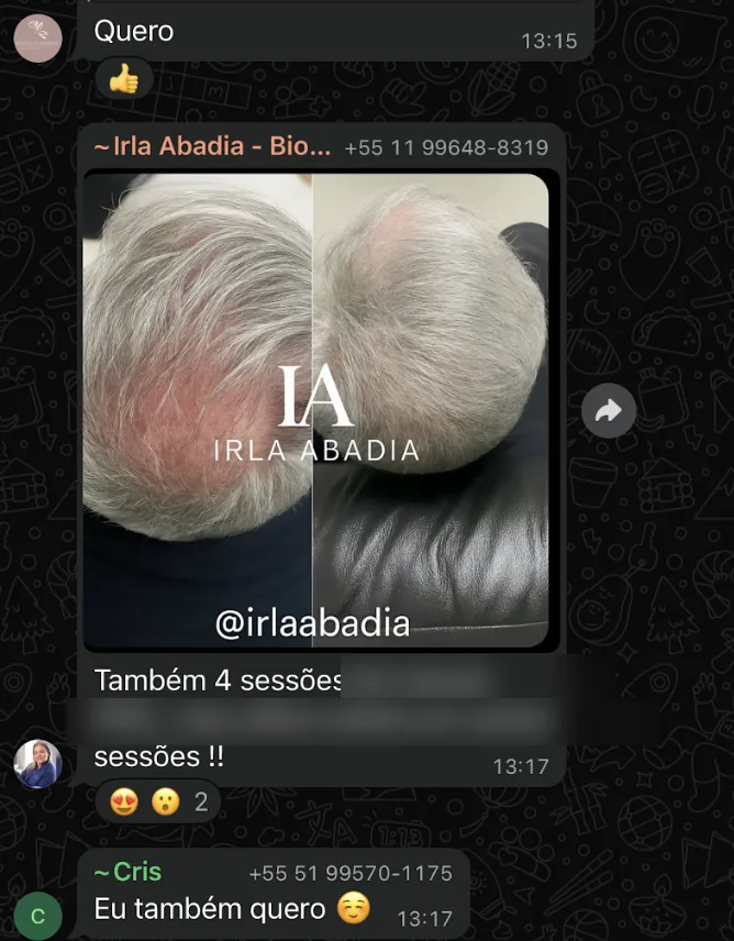 Resultado real — 4 sessões