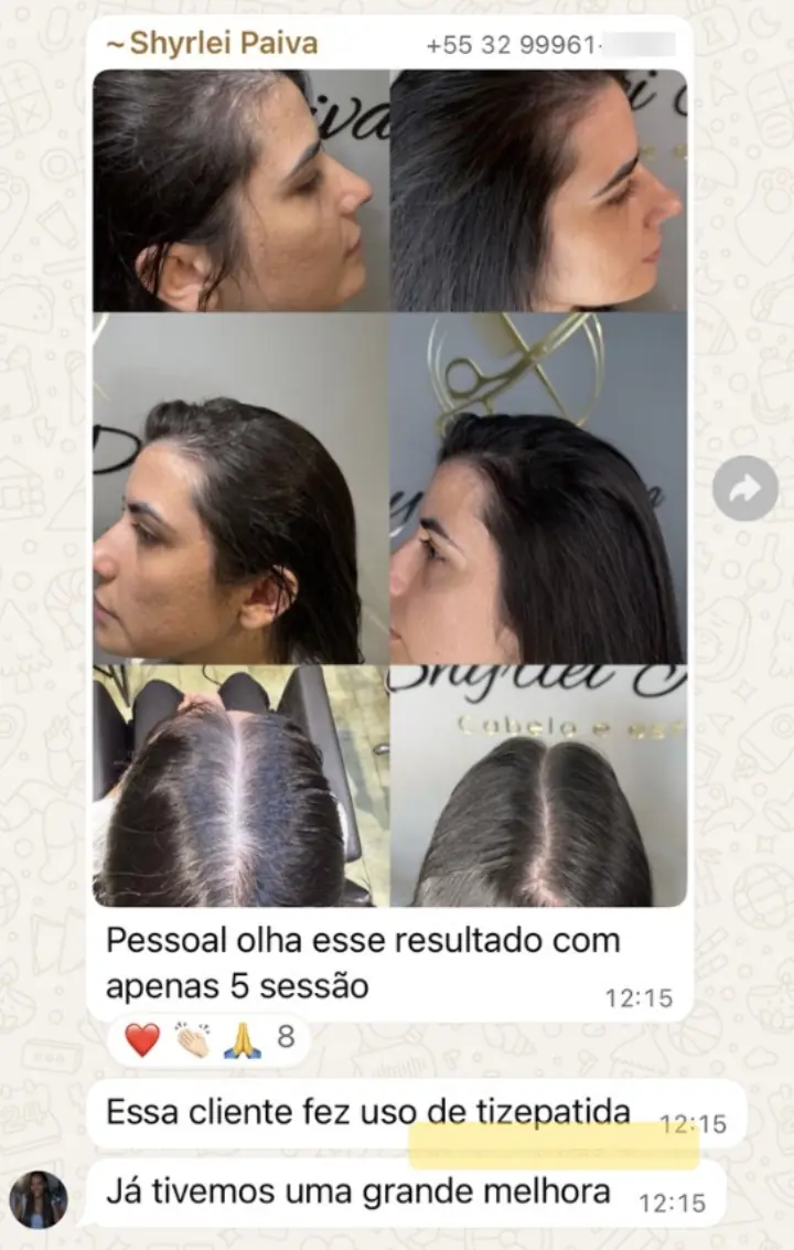 Resultado real — 5 sessões