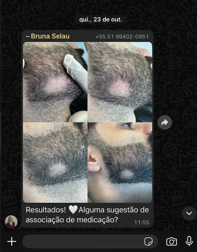 Resultado real — 45 dias