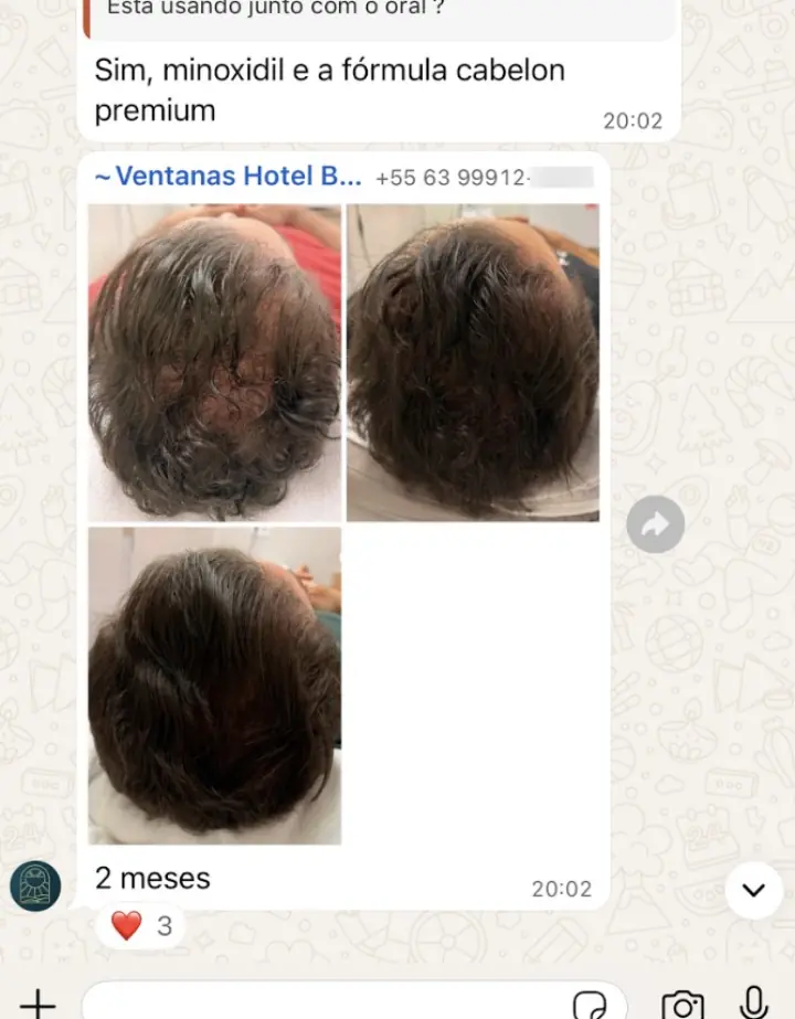 Resultado real — 60 dias