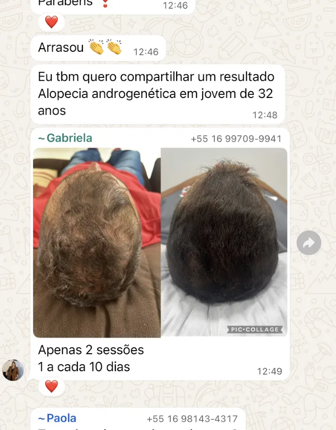 Resultado real — 2 sessões