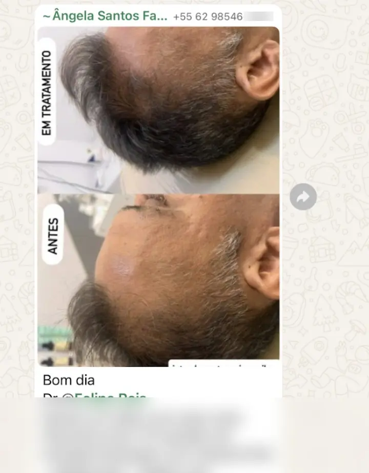 Resultado real — 10 sessões