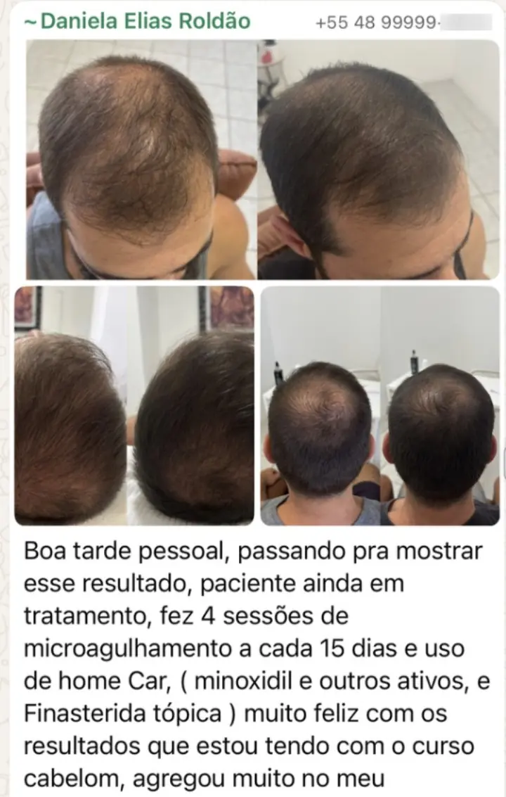 Resultado real — 4 sessões