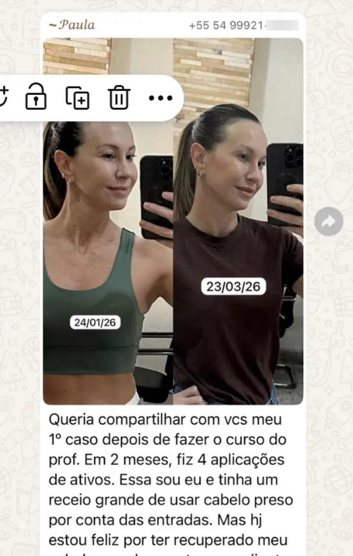 Resultado real — 4 sessões